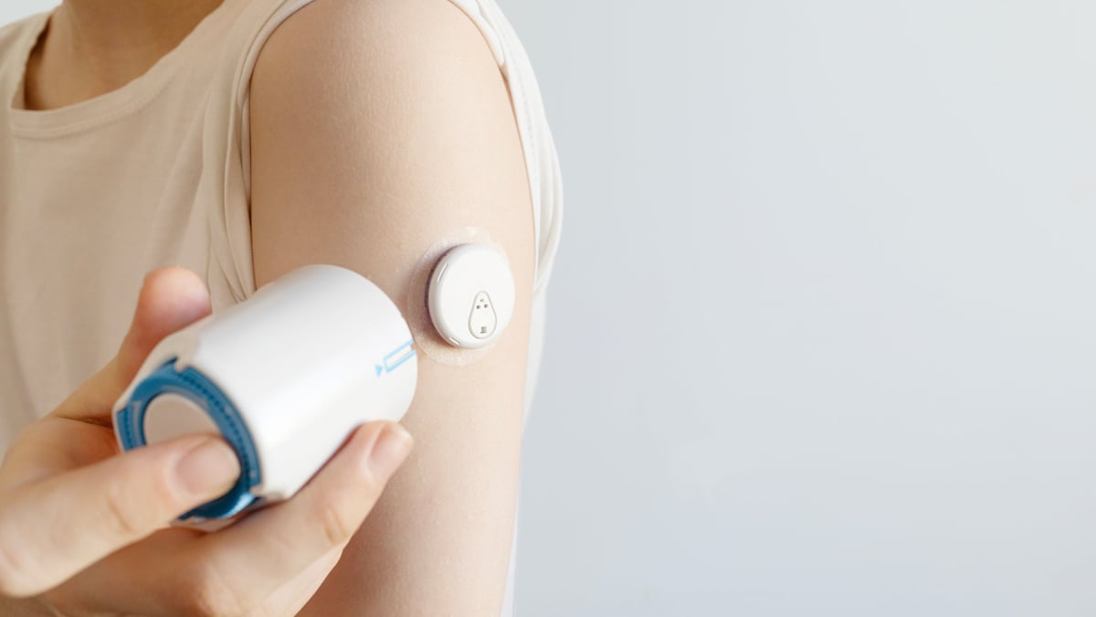 Applying Continuous Glucose Monitor Sensor on Arm with Applicator. Concept of Diabetes Care, medical Installation, modern health Technology, and Patient Self-injection for active Disease Management
