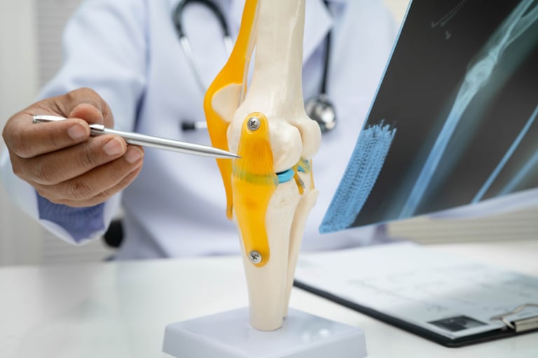 Doctor examining knee joint bone radiography xray film