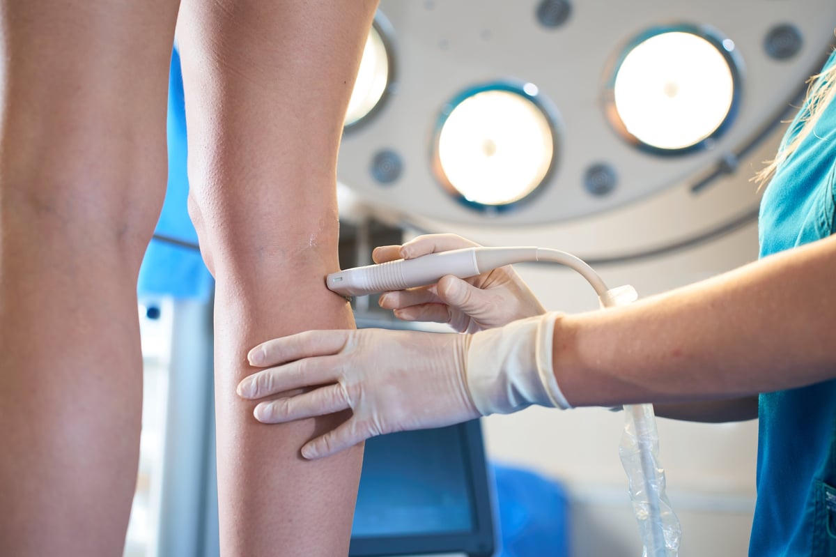 Phlebology Ultrasound Diagnostic. Doctor performs ultrasound scan of leg veins on female patient to diagnose venous insufficiency.